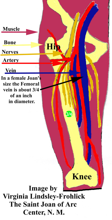 APPENDIX VI